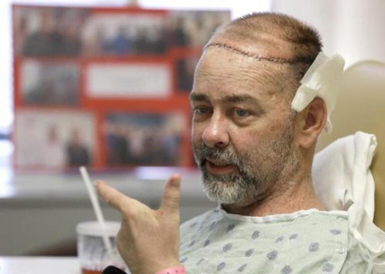 U Teksasu obavljena prva transplantacija lobanje